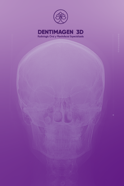 Radiografía Posteroanterior de Cráneo (PA)